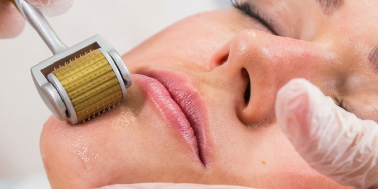 Dermapen Skin Needling – The Good & The Bad