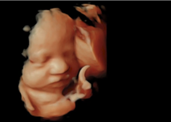 14 to 19 Week 3D/4D Ultrasounds: Everything You Need to Know