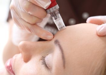 Micro-needling with PRP: Advantages and disadvantages