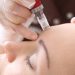 Micro-needling with PRP: Advantages and disadvantages