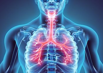 What is Chronic Obstructive Pulmonary Disease?