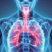What is Chronic Obstructive Pulmonary Disease?
