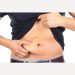 Is Liposuction a way to deal with obesity?