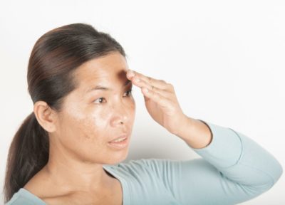 SPF Full Form Explained and Its Importance for Pigmentation