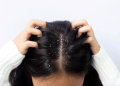 Why Dandruff is More Common in India’s Humid Climate — And How to Fight It Year-Round