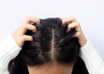 Why Dandruff is More Common in India’s Humid Climate — And How to Fight It Year-Round